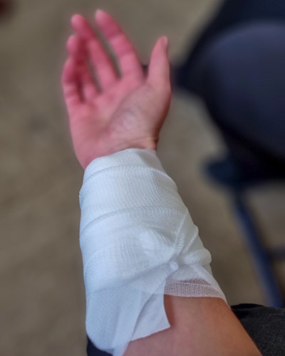 Verband am Unterarm.